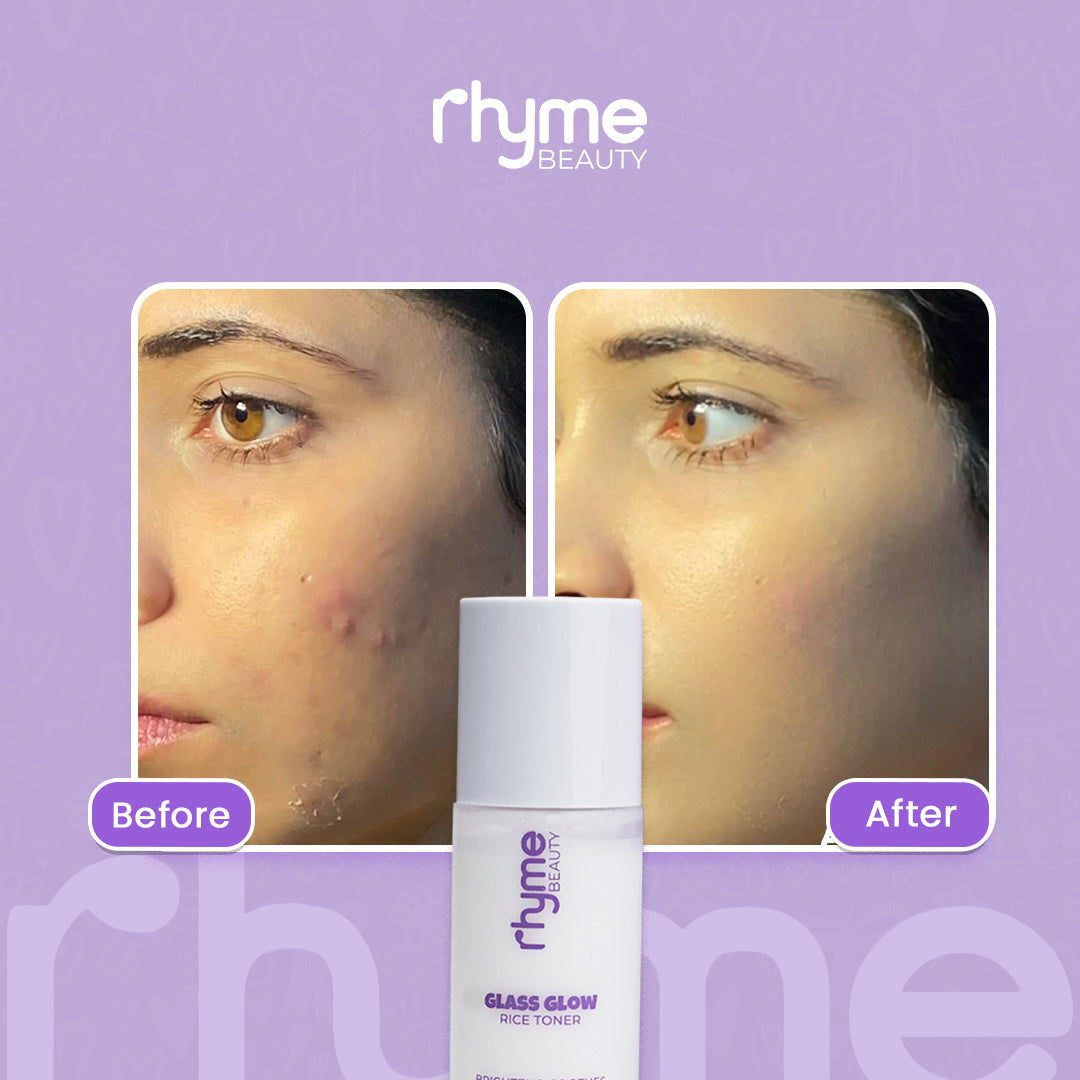 Glass Glow Rice Toner