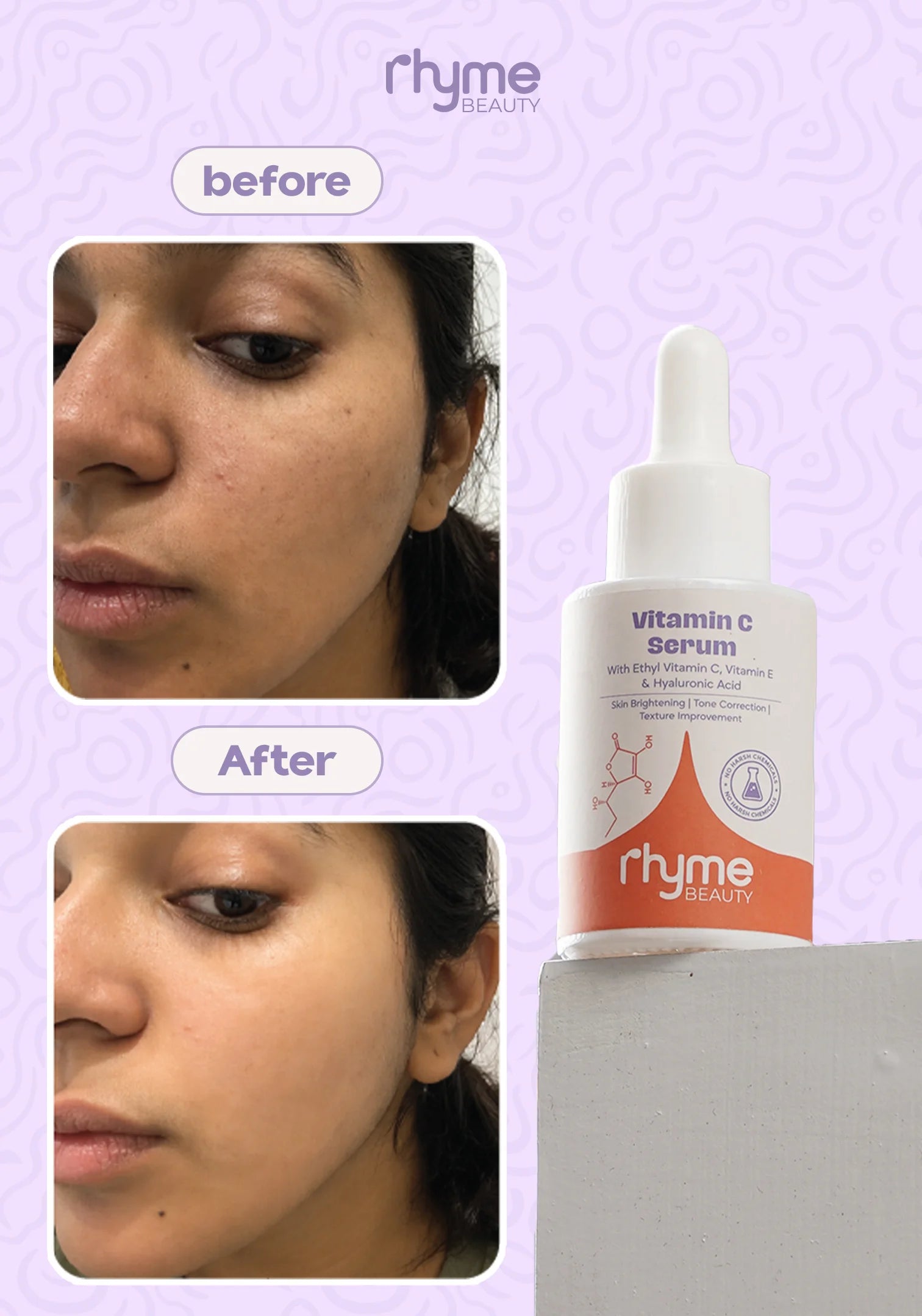 Vitamin C Serum