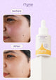 Brightening Serum